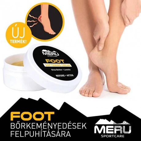 FOOT - Sarokpuhító krém - 30ml
