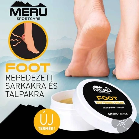 FOOT - Sarokpuhító krém - 30ml